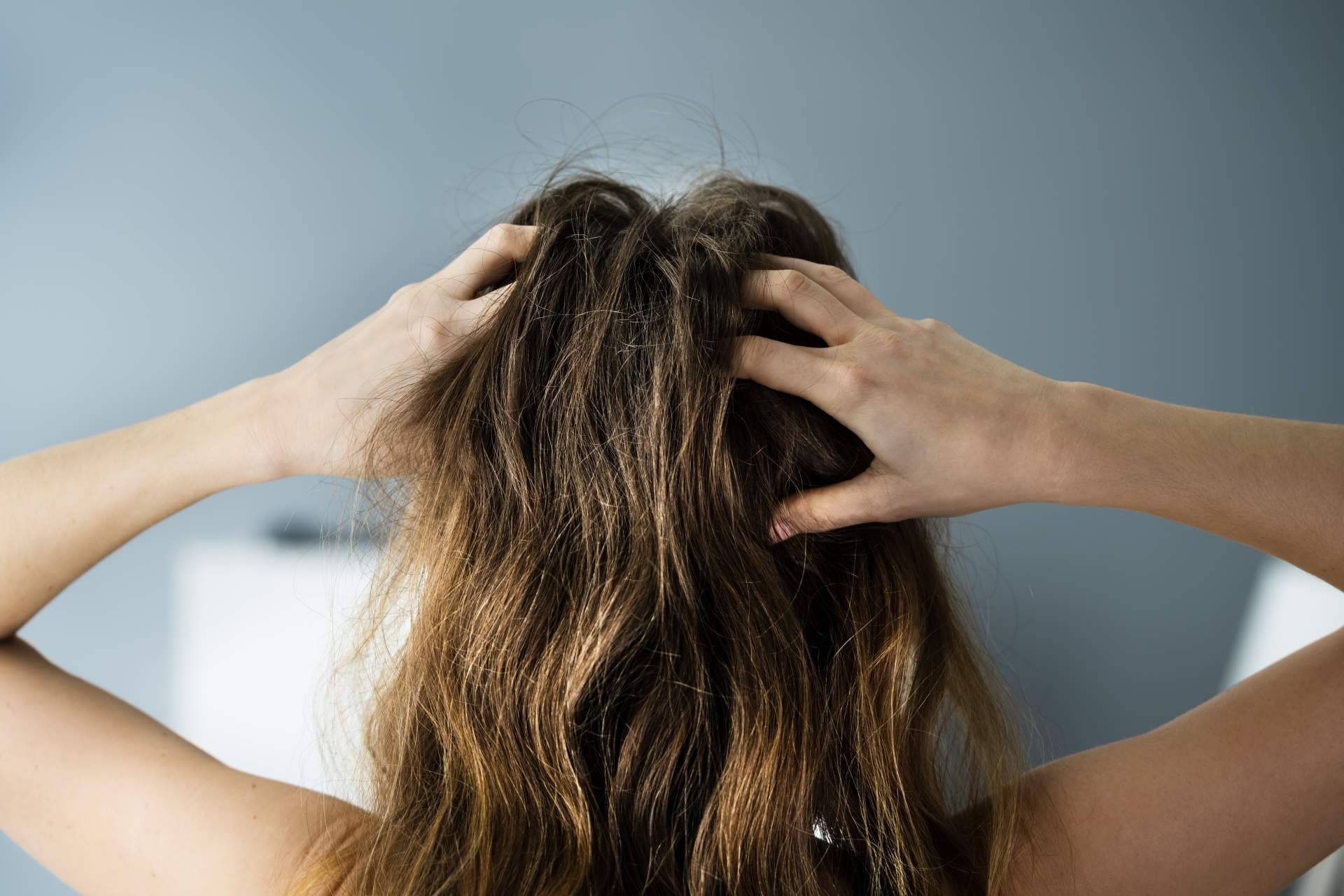 Productos orgánicos sin sulfatos para sanar un cuero cabelludo irritado y sensible