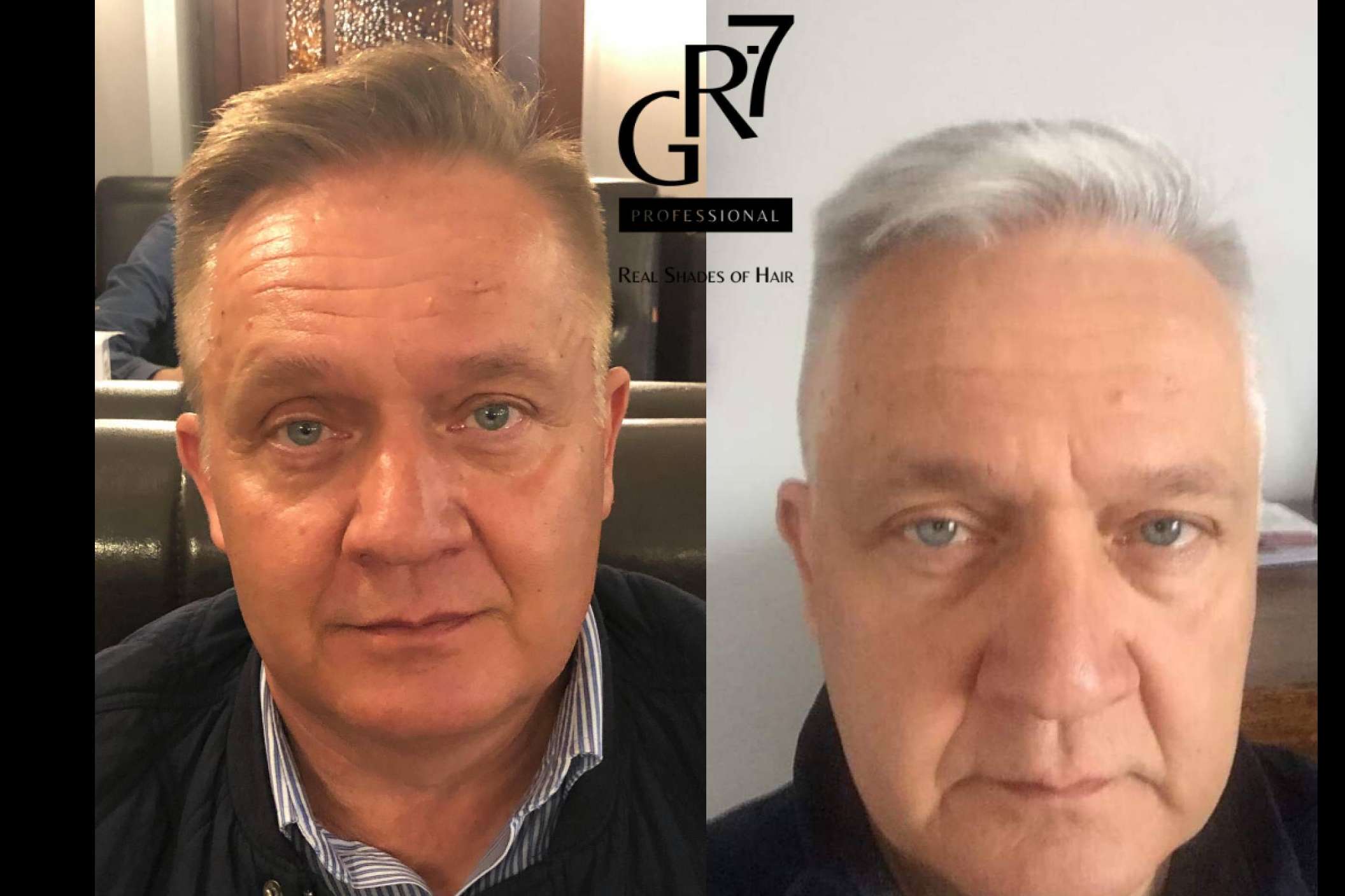 Loción GR-7 Professional revierte la aparición de canas y devuelve el color natural