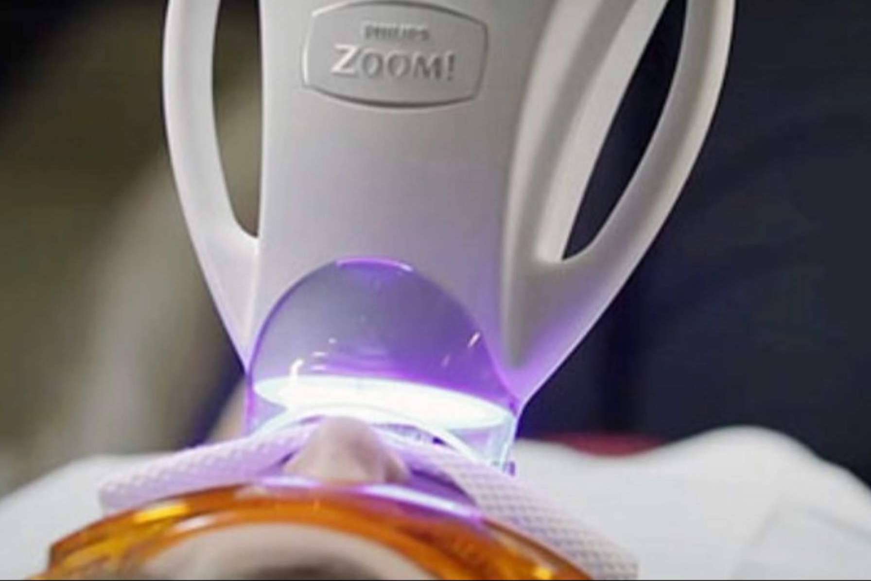 El blanqueamiento dental en casa refuerza y mantiene los resultados del procedimiento clínico