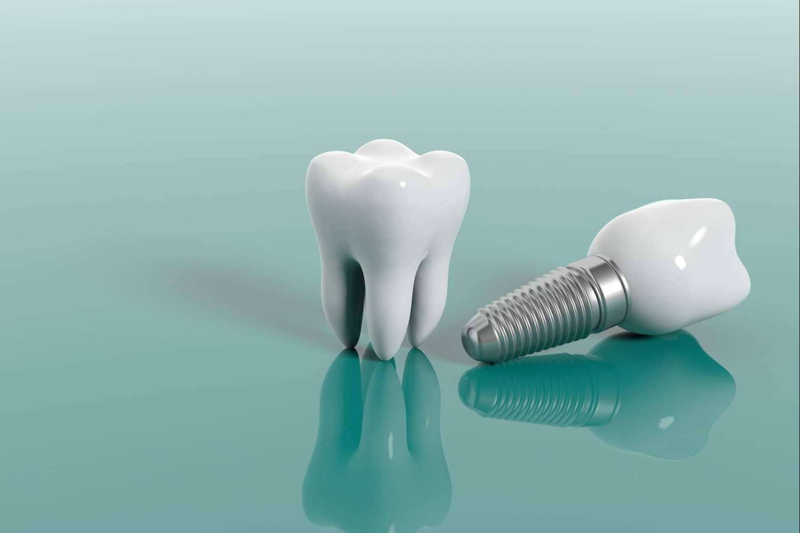 Clínica Dental Ahoa ofrece tratamientos de implantología dental de carga inmediata