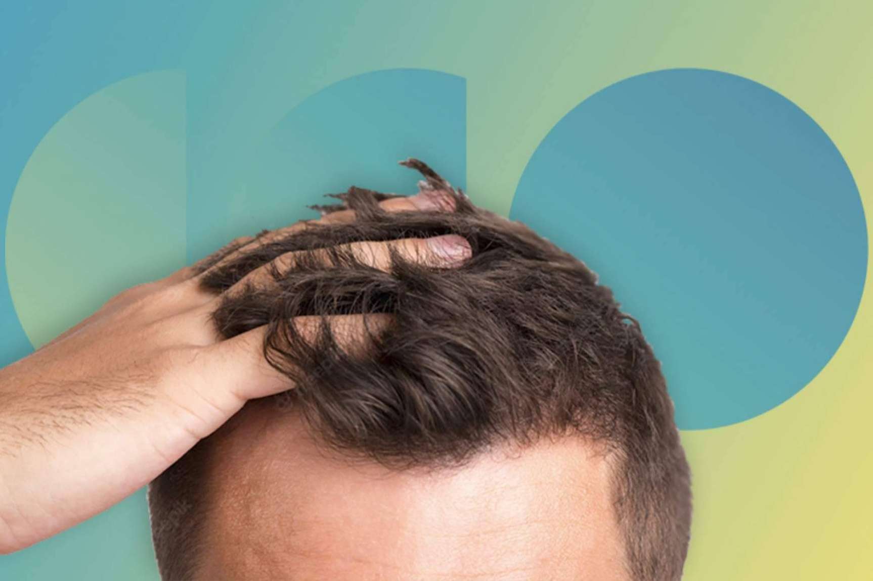 La caída de cabello estacional viene más fuerte este año