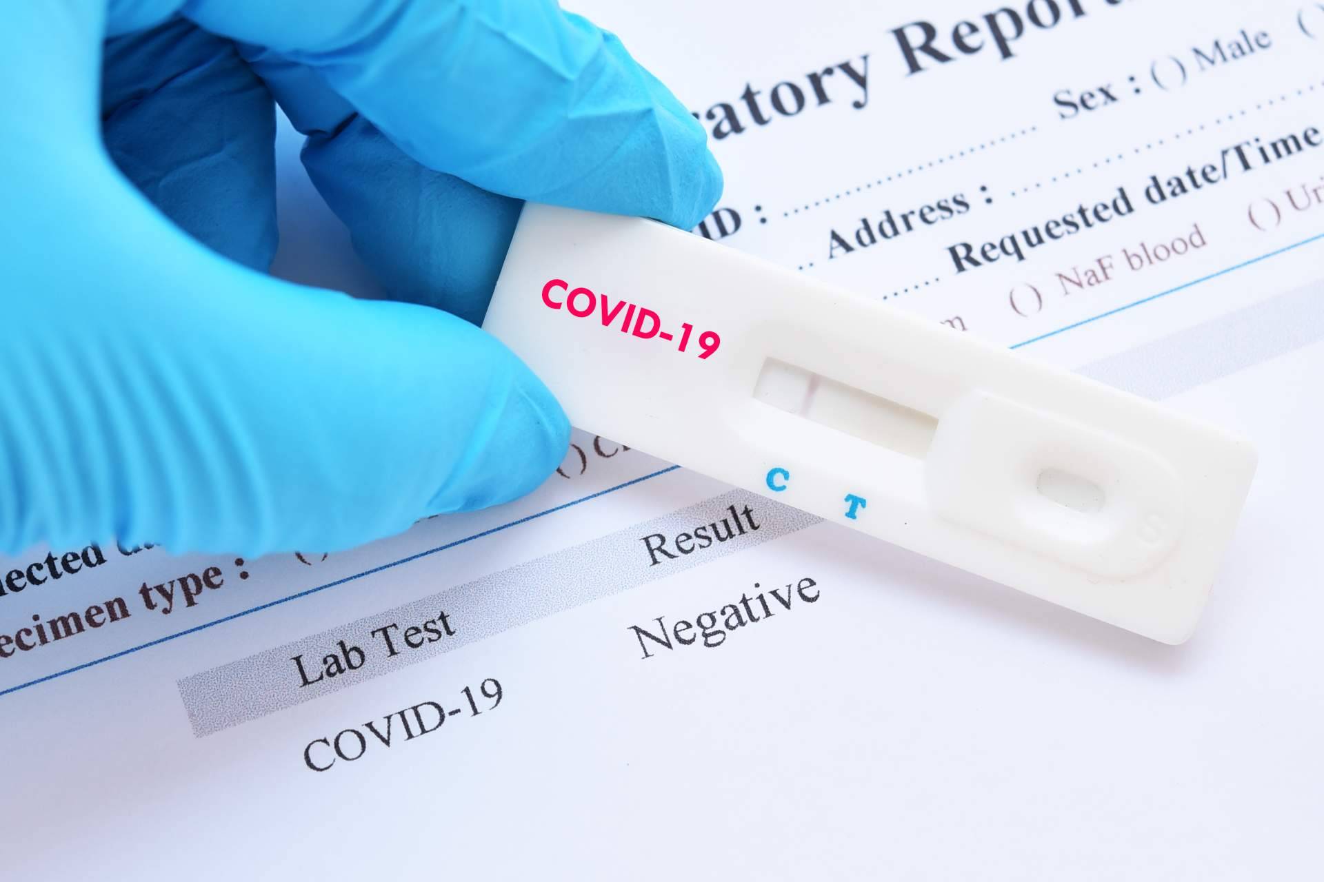 La importancia de haber utilizado el test covid para las fiestas navideñas, de la mano de Centro Médico Bravo