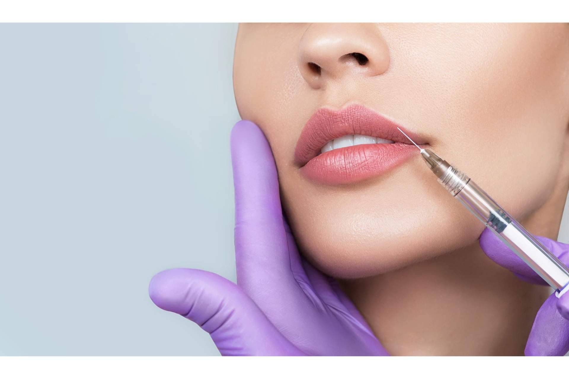Extreme lips, la técnica innovadora de 360Clinics para un aumento de labios