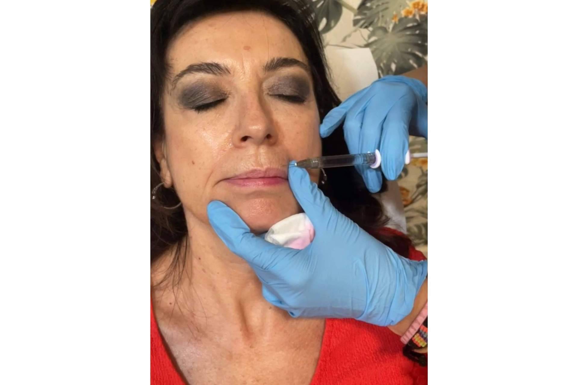Clínica estética Cecilia Arthur, especialistas en blanching