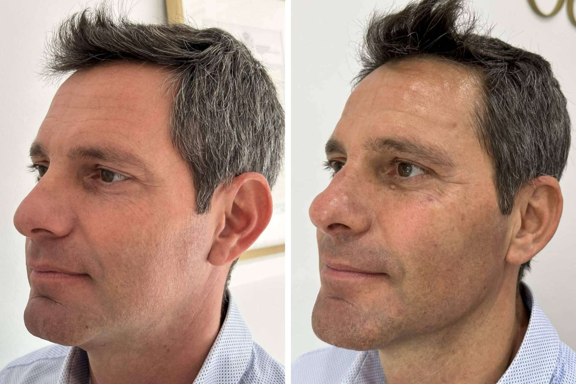 Clínica VISO permite mejorar la apariencia a través de sus tratamientos faciales