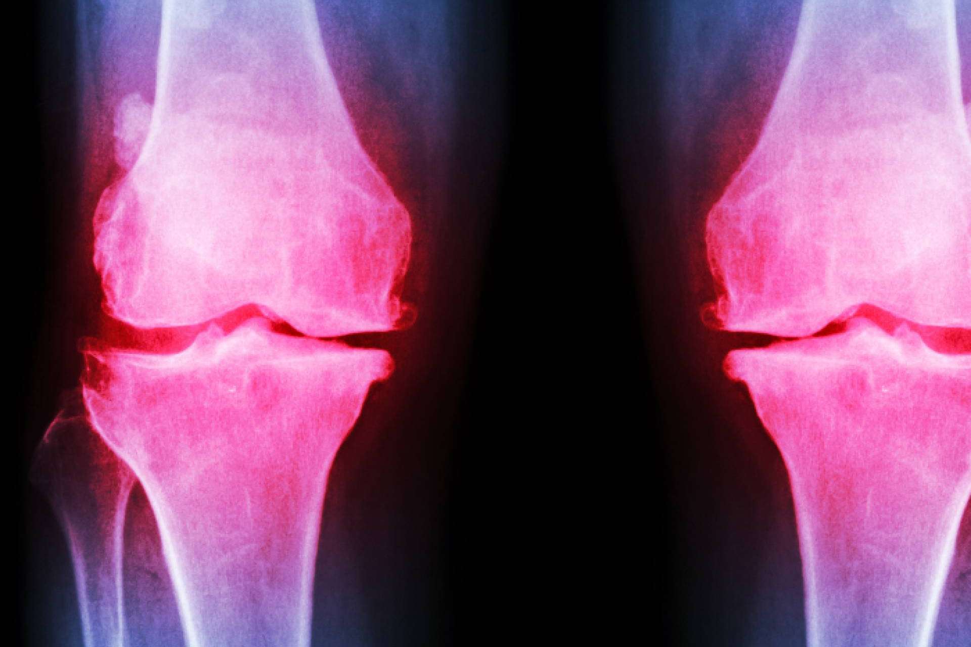 Mucha gente sufre dolor sin saber qué le sucede y en ocasiones es algo grave. La clínica de fisioterapia avanzada que ayuda a encontrar soluciones
