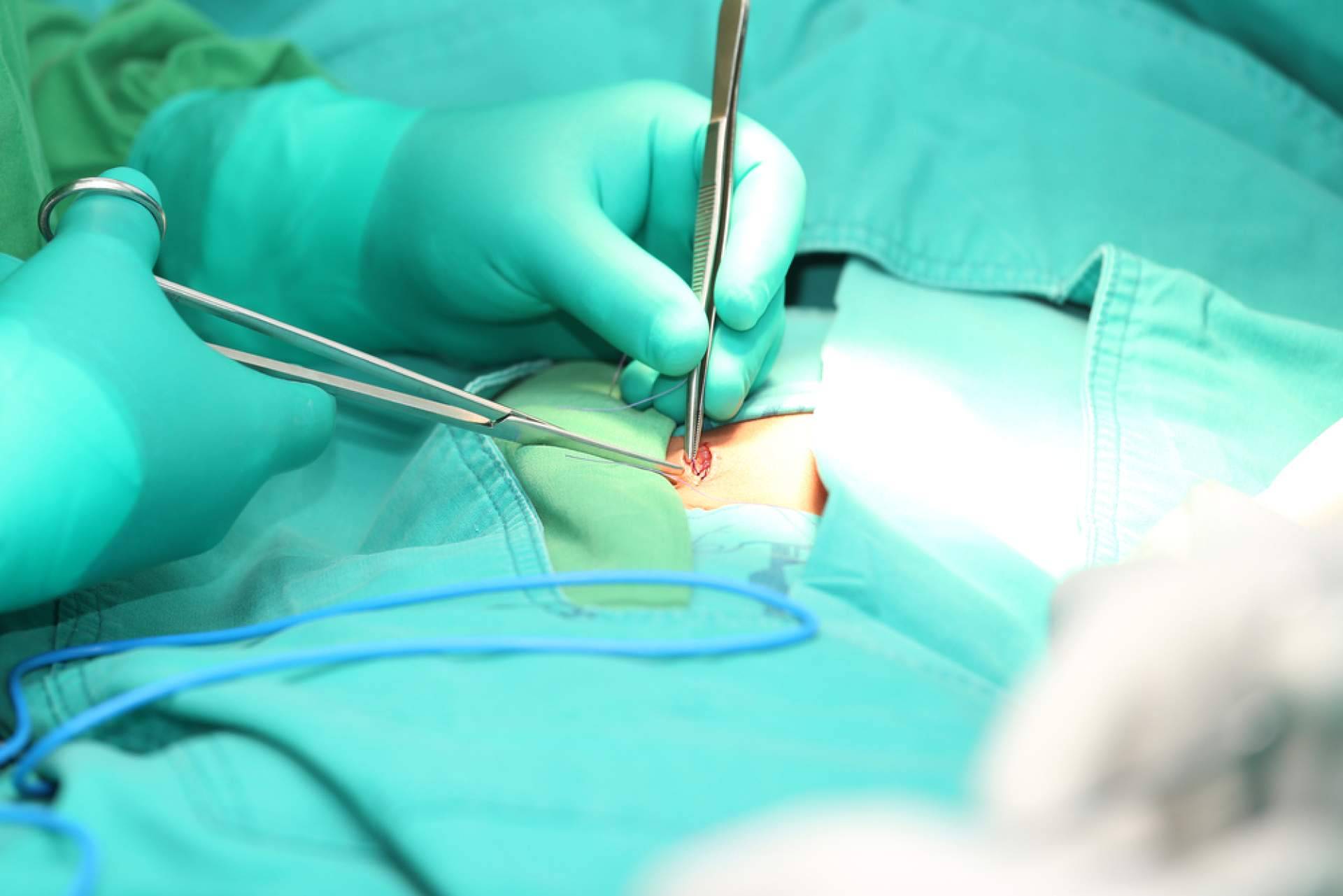 El Dr. Javier Martínez Pascuas resuelve algunas dudas sobre la cirugía de hernia inguinal