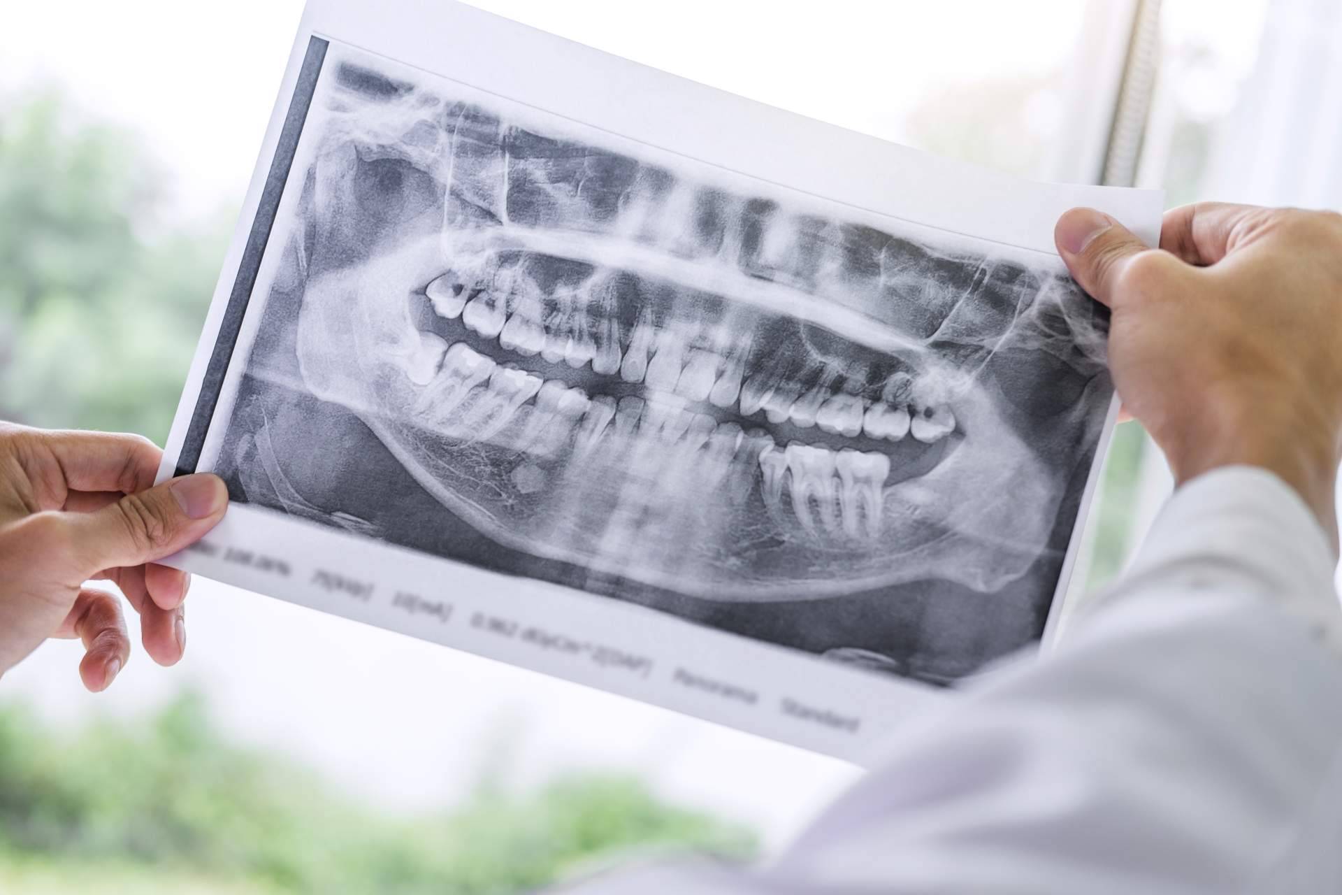 10 razones para buscar un maxilofacial para la boca