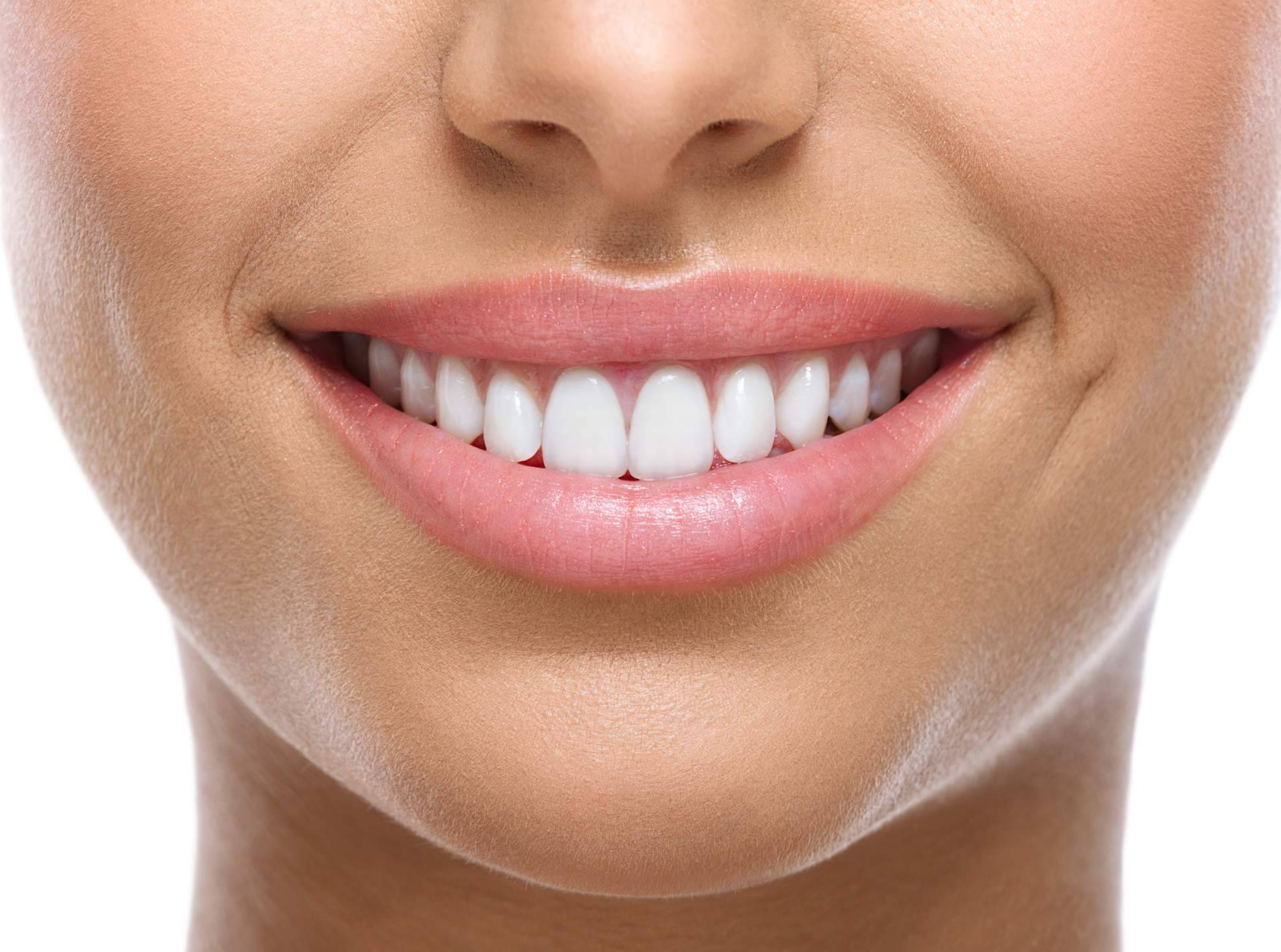 Cuáles son los beneficios de los implantes dentales de la Clínica Dental Agudo Rosa