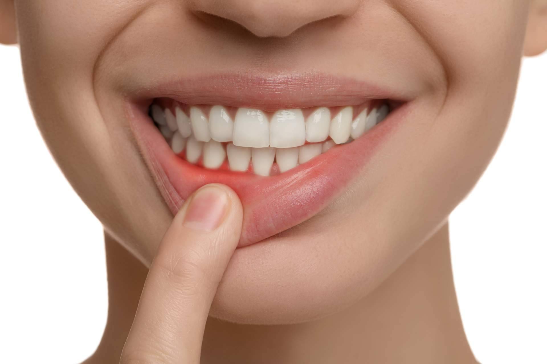 Clínica Dental Agudo Rosa explica cómo tratar la enfermedad de las encías