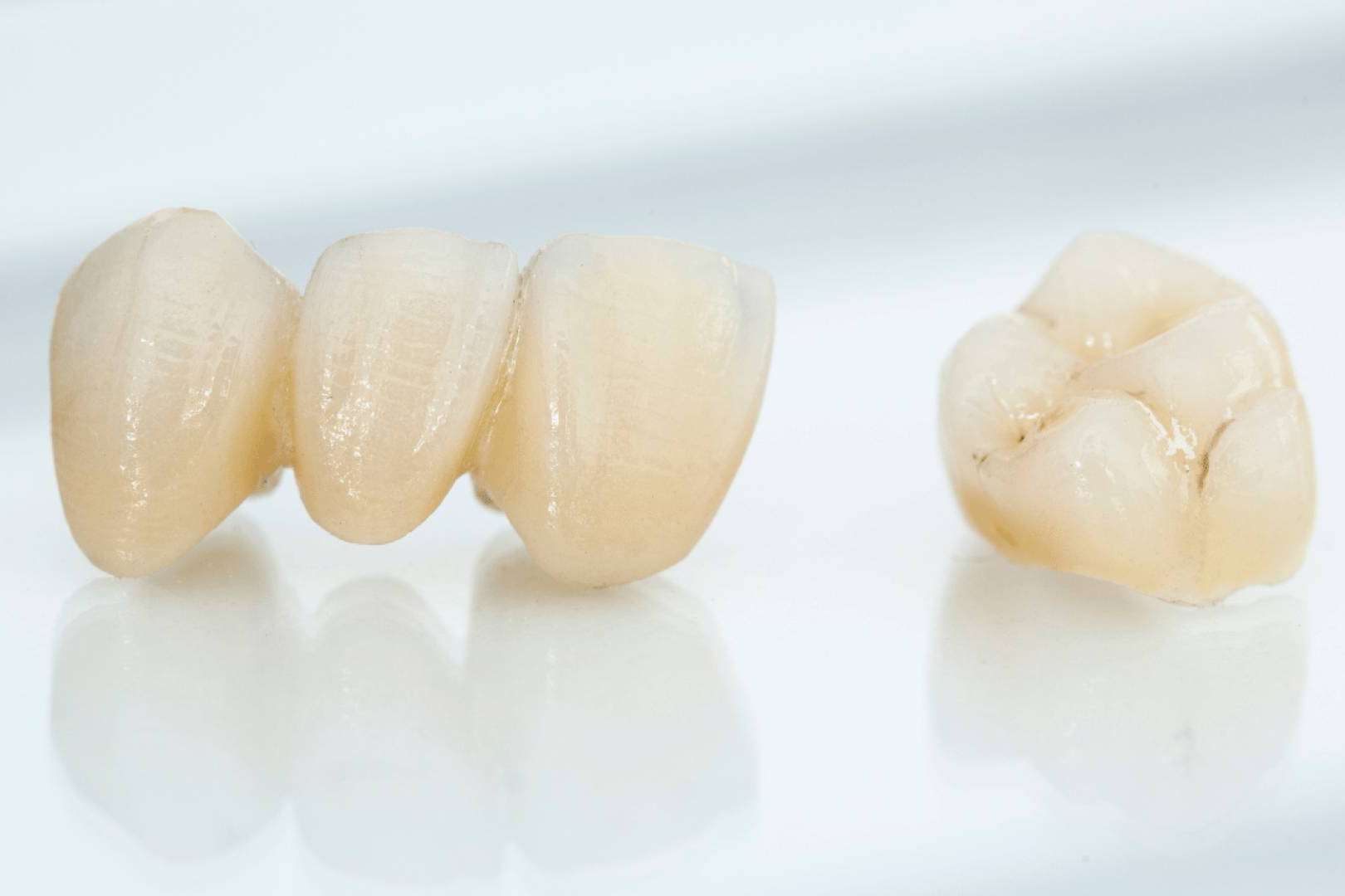 Recuperar la sonrisa perfecta con ayuda de coronas dentales, la solución estética y duradera que ofrece la Clínica Dental Ruiz de Gopegui