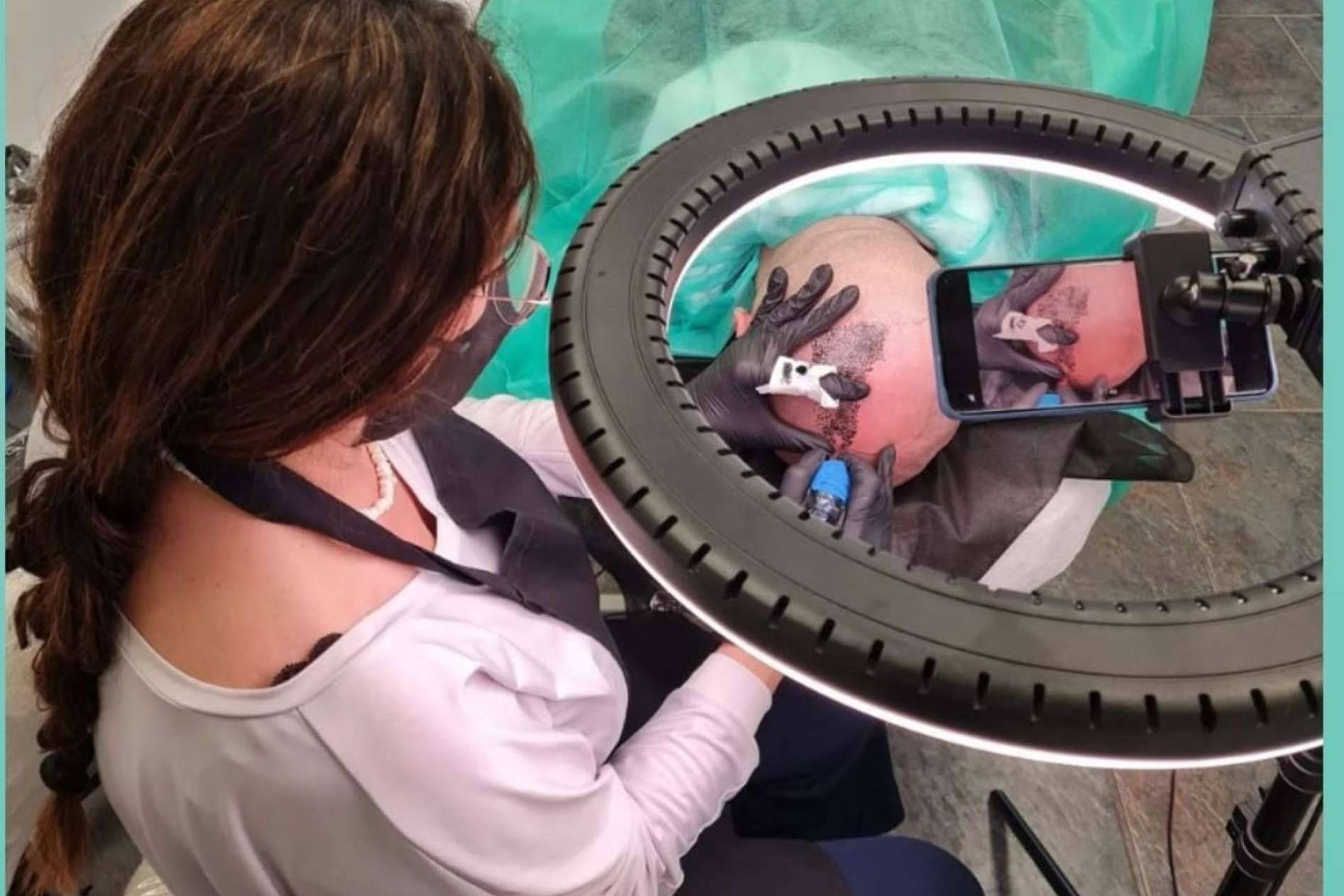 Las ventajas de la micropigmentación capilar, por Dermopigmentación Clínica