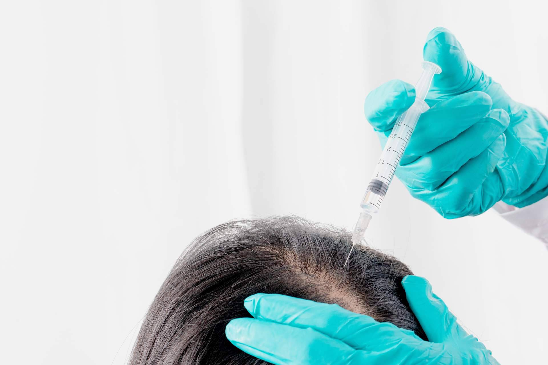 PRP capilar, el tratamiento innovador de Centro Estética El Pilar que estimula el crecimiento del cabello
