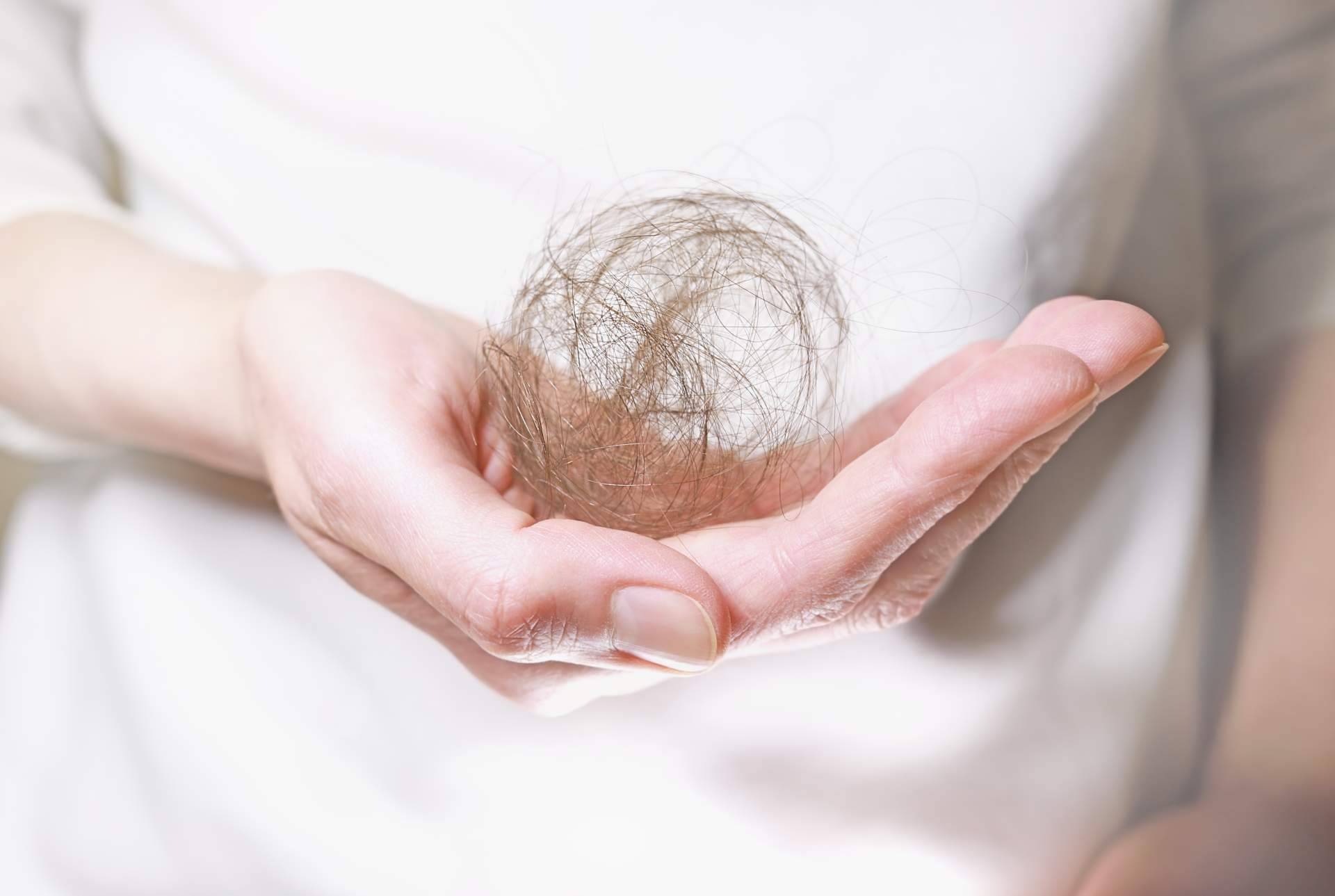 Capilar Innovation Clinic y su solución para hacer frente a la alopecia andrógenetica femenina