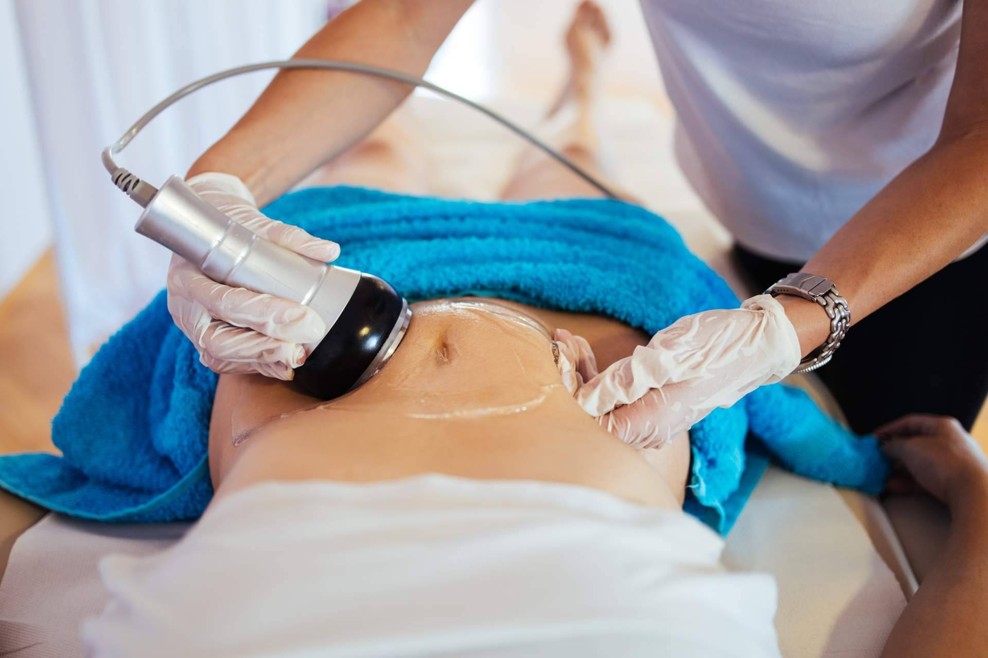 ¿En qué consiste el tratamiento de radiofrecuencia corporal?, por Centro Médico El Pilar