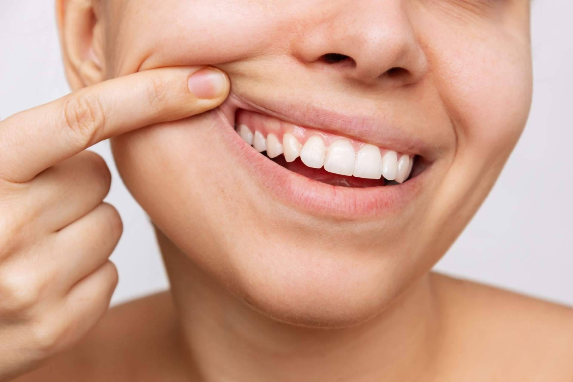 Claves para tener salud bucodental, por Farmasky