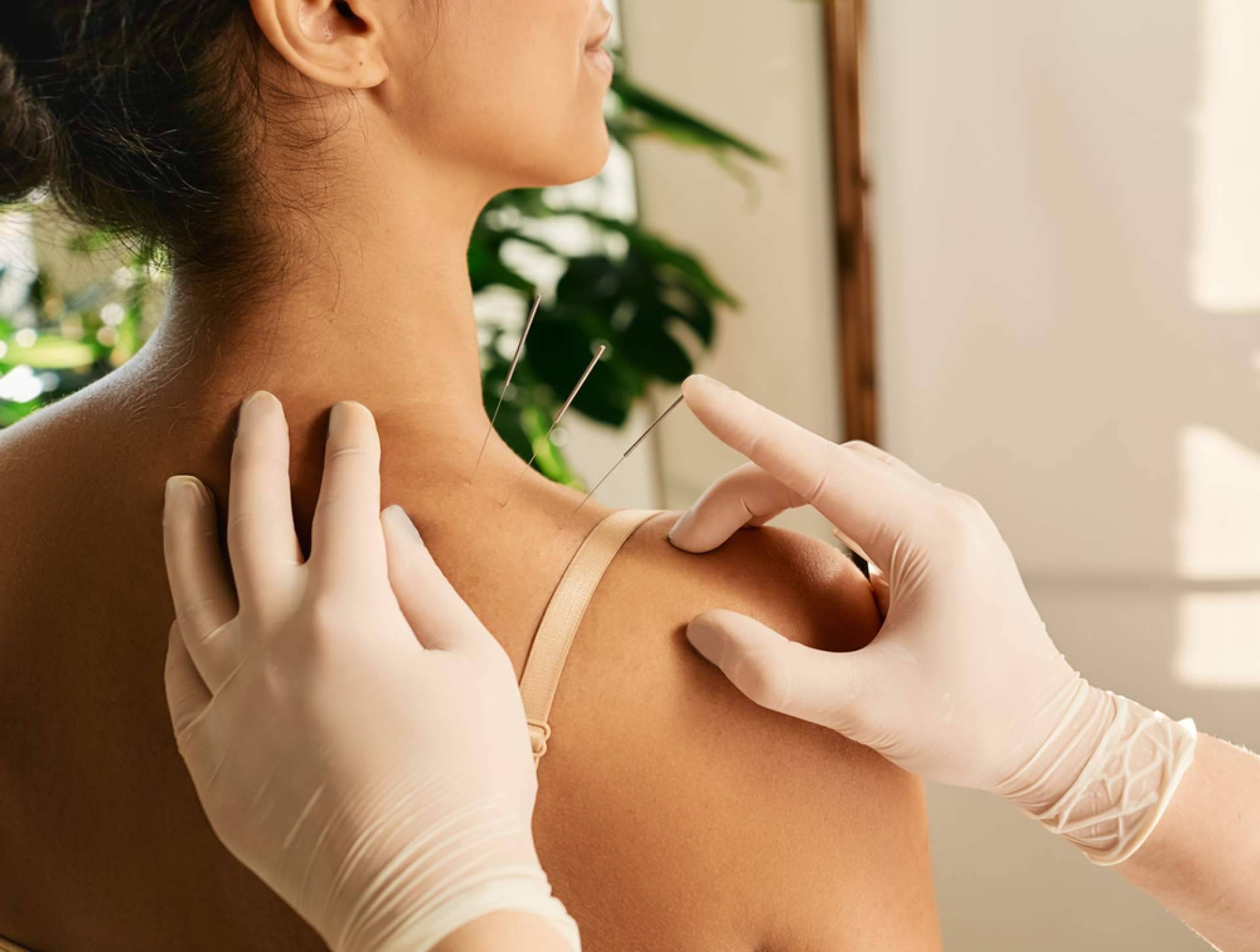 Los múltiples beneficios para la salud que aporta la acupuntura, por Shenti Wellness