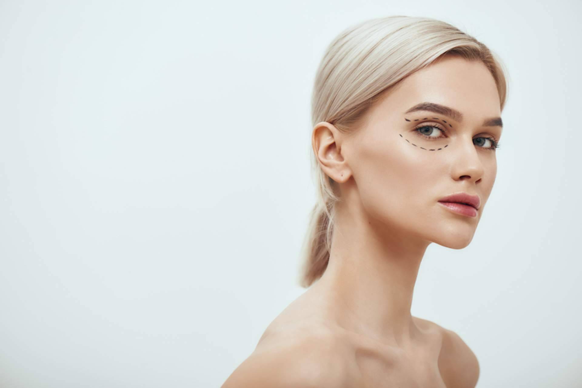 Tratar los párpados superiores e inferiores cuando existe piel redundante con la ayuda de la blefaroplastia no quirúrgica