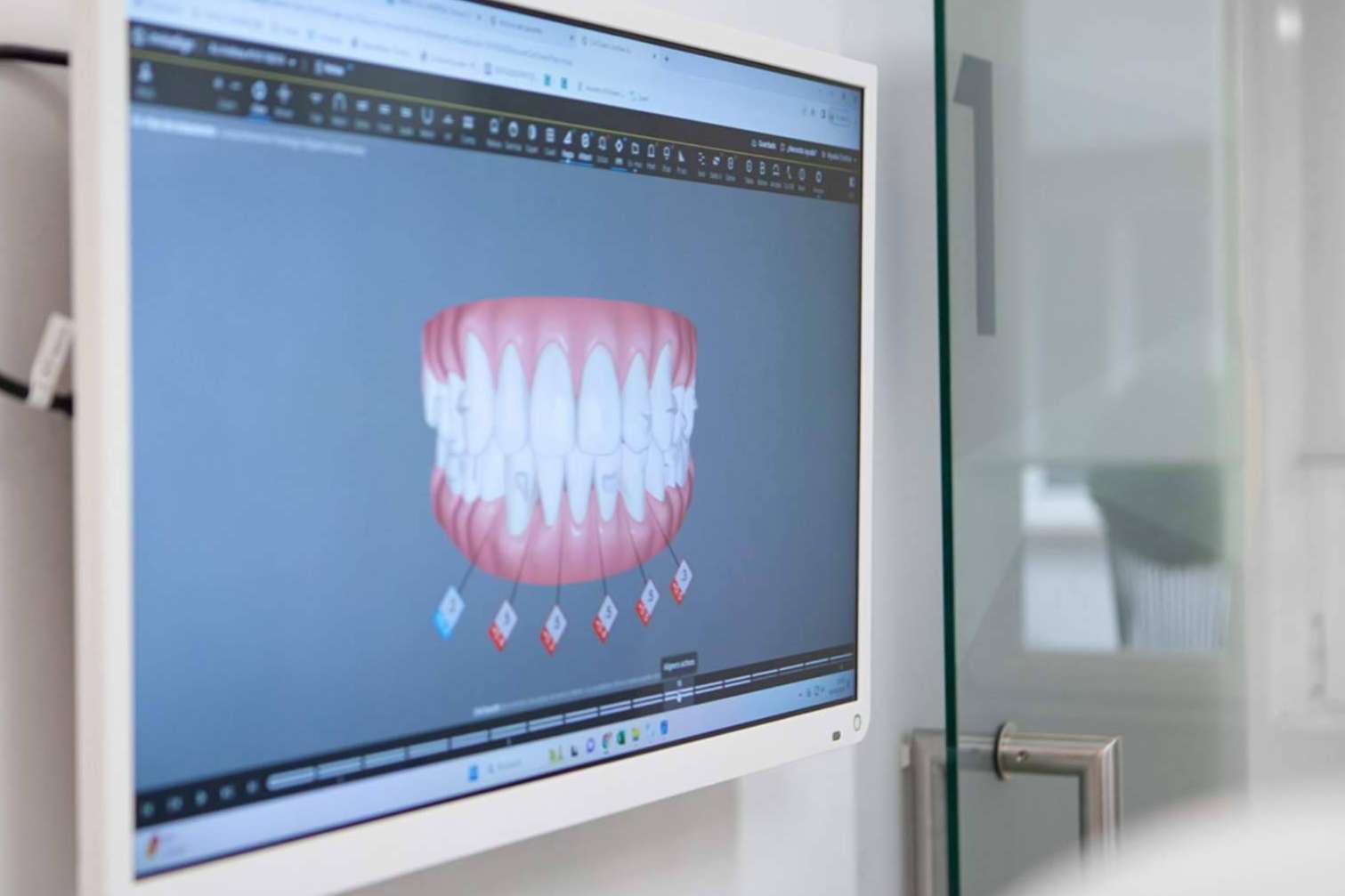 CLÍNICA CRISTINA VIYUELA + CO ofrece ortodoncia invisible Invisalign para la maloclusión dental
