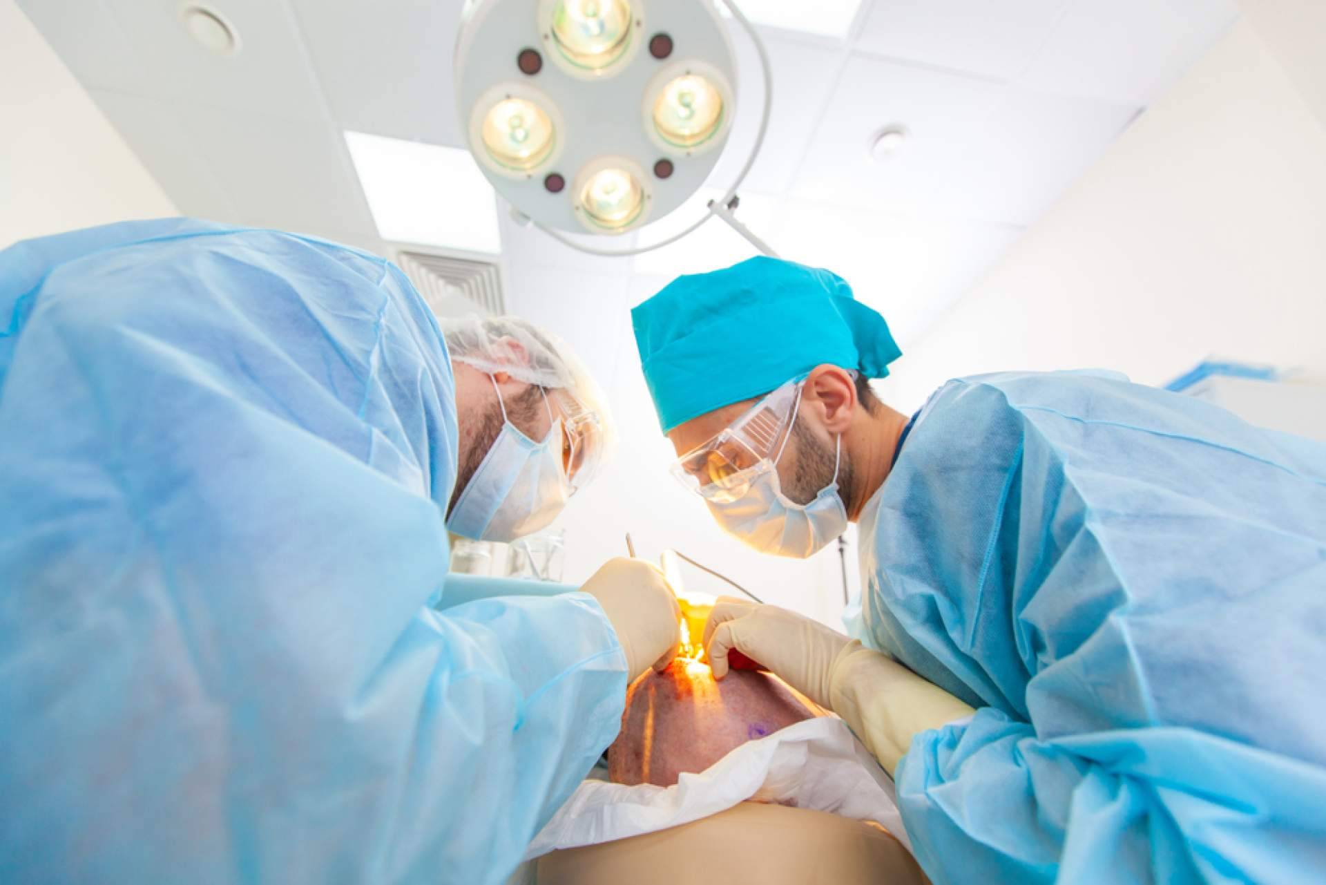 Las últimas técnicas en trasplante capilar de la mano de Capilar Innovation