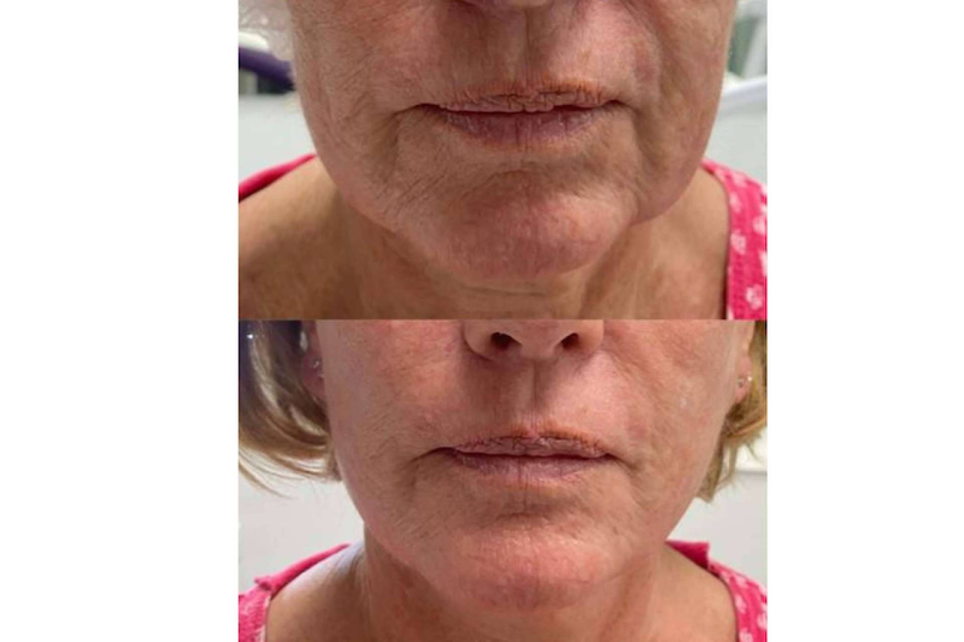 Los aspectos clave de los tratamientos de Dr. Guidi en medicina estética facial
