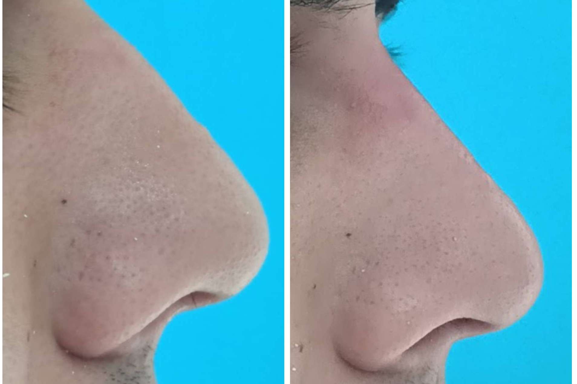 Clínica Calvo de Mora ofrece medicina estética facial y dental para una sonrisa perfecta