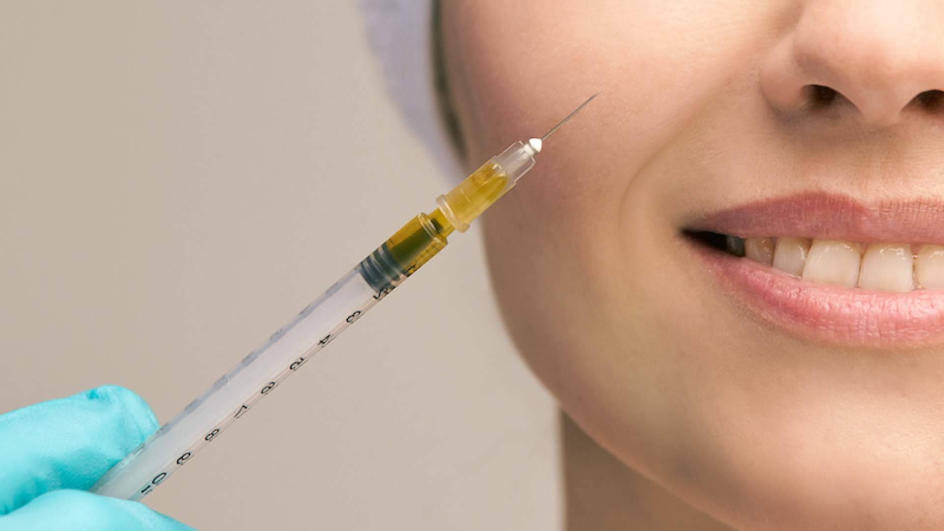 Plasma rico en plaquetas facial, Centro Estética El Pilar