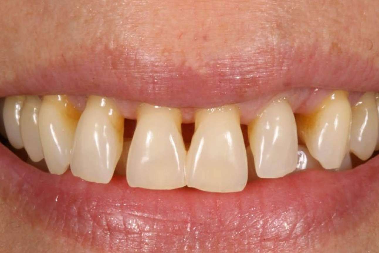 La importancia de la prevención y el tratamiento de las enfermedades periodontales