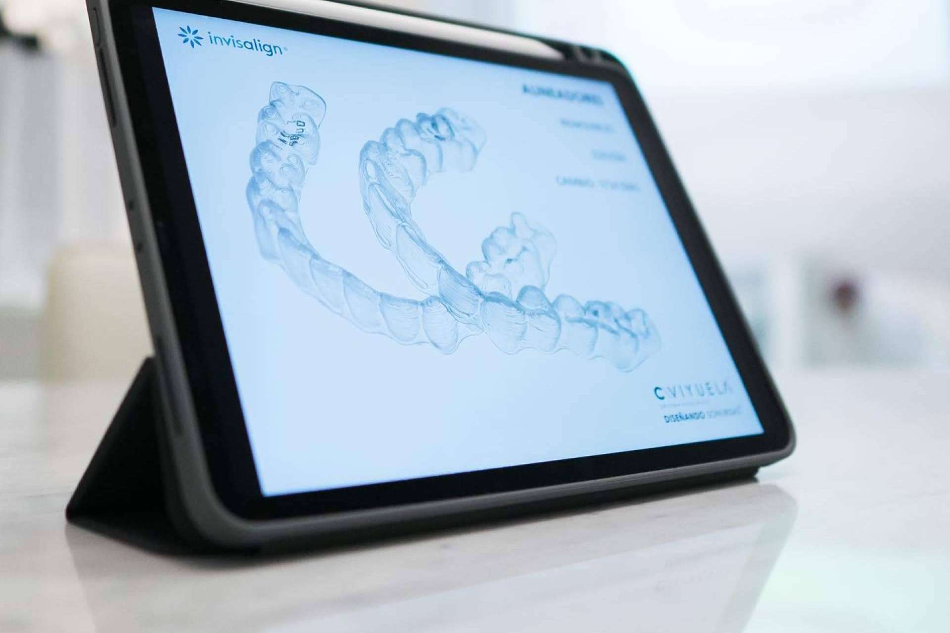 ¿Qué diferencia a un ortodoncista de otro en la ortodoncia invisible con la técnica Invisalign?, según Doctora Viyuela