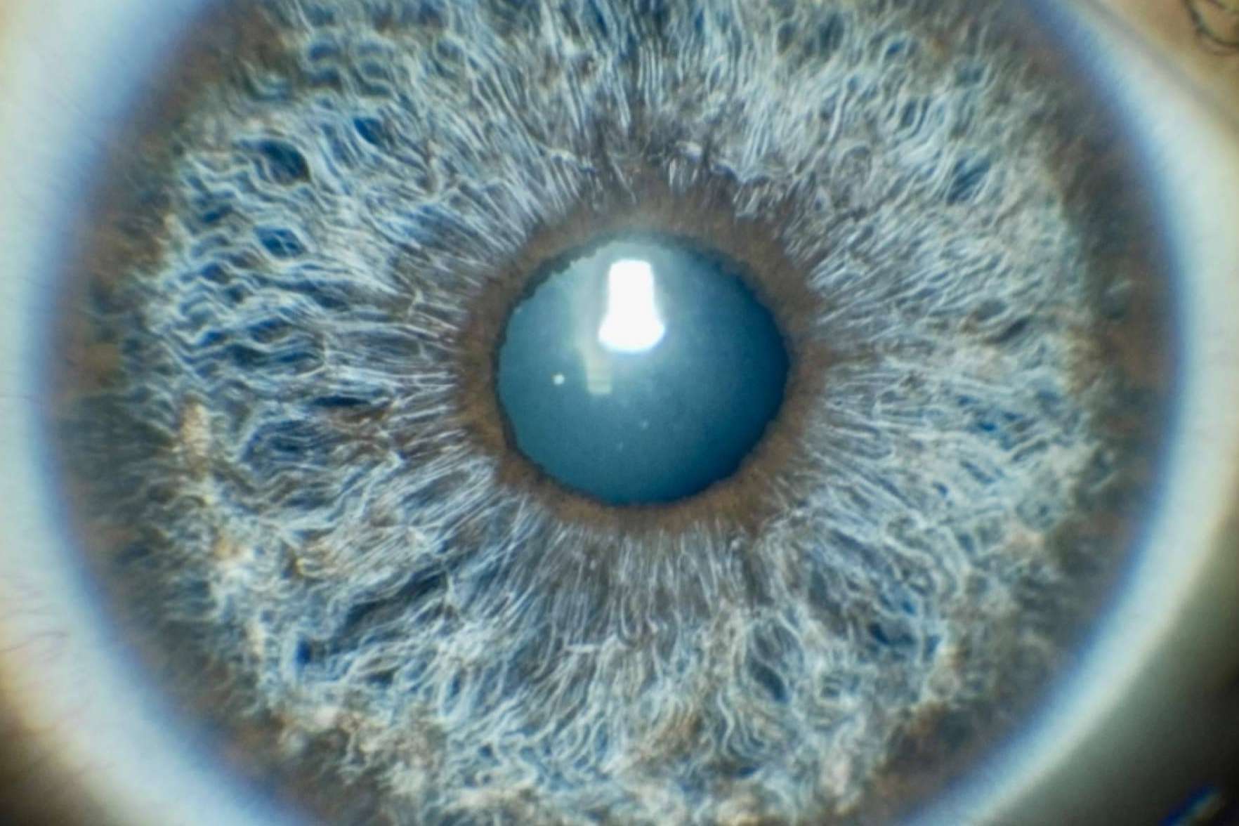 Eyecos permite predecir y simular en 3D el resultado del cambio de color de ojos con láser