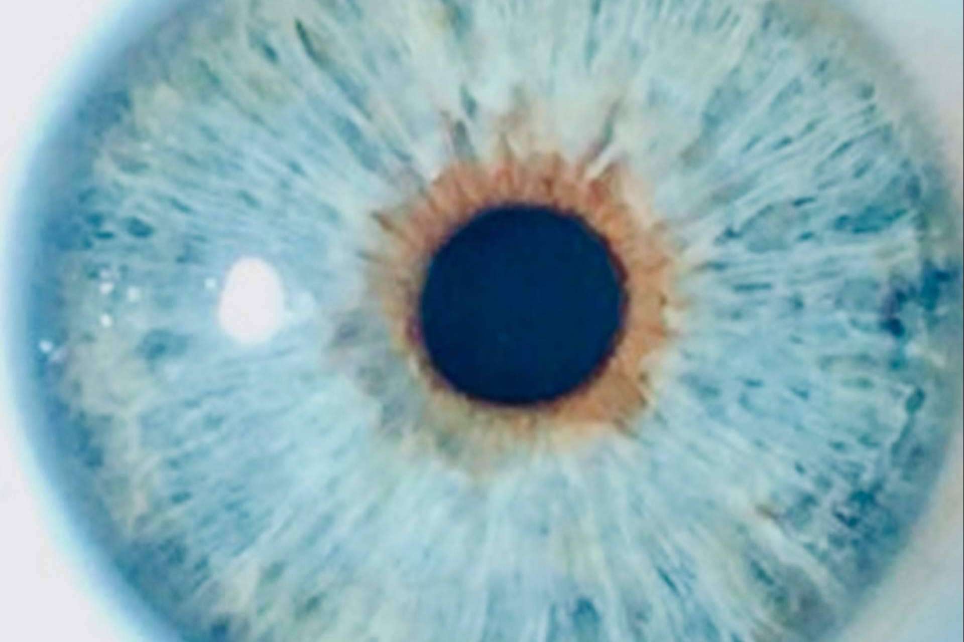 ¿Por qué la gente quiere cambiarse el color de los ojos con láser?, por Eyecos