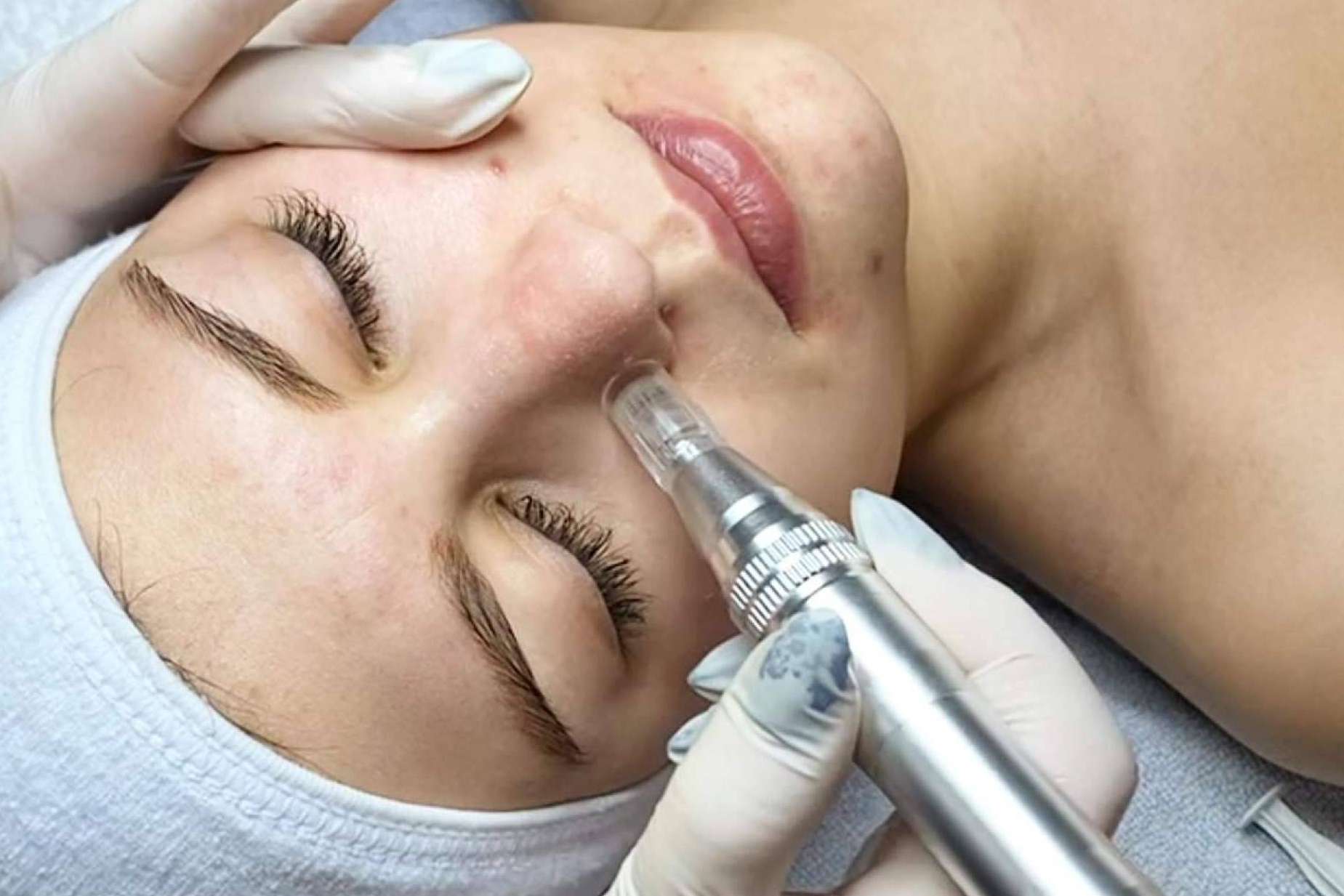 Calidad en los servicios del centro de estética en Terrassa y Madrid de Cynthia Micro & Beauty