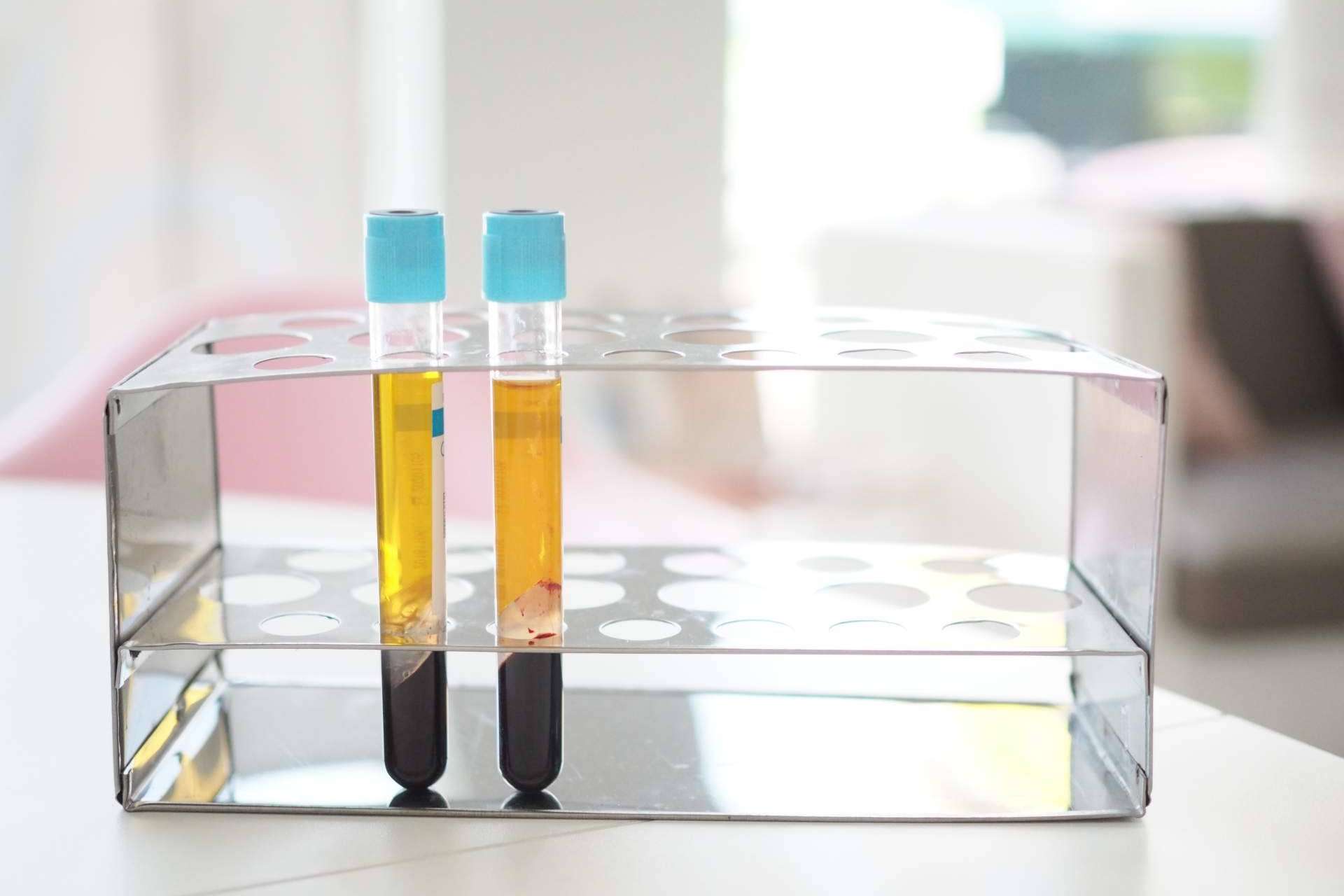 Centro Estética El Pilar y su innovador tratamiento de plasma rico en plaquetas