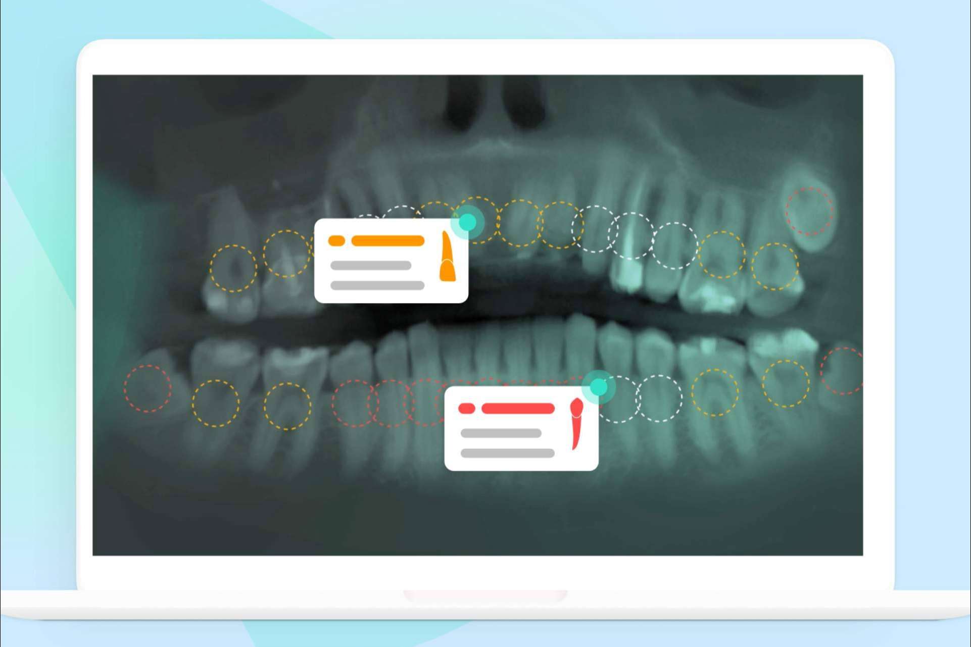 El diagnóstico potenciado por inteligencia artificial que revoluciona la práctica odontológica, Dentomo