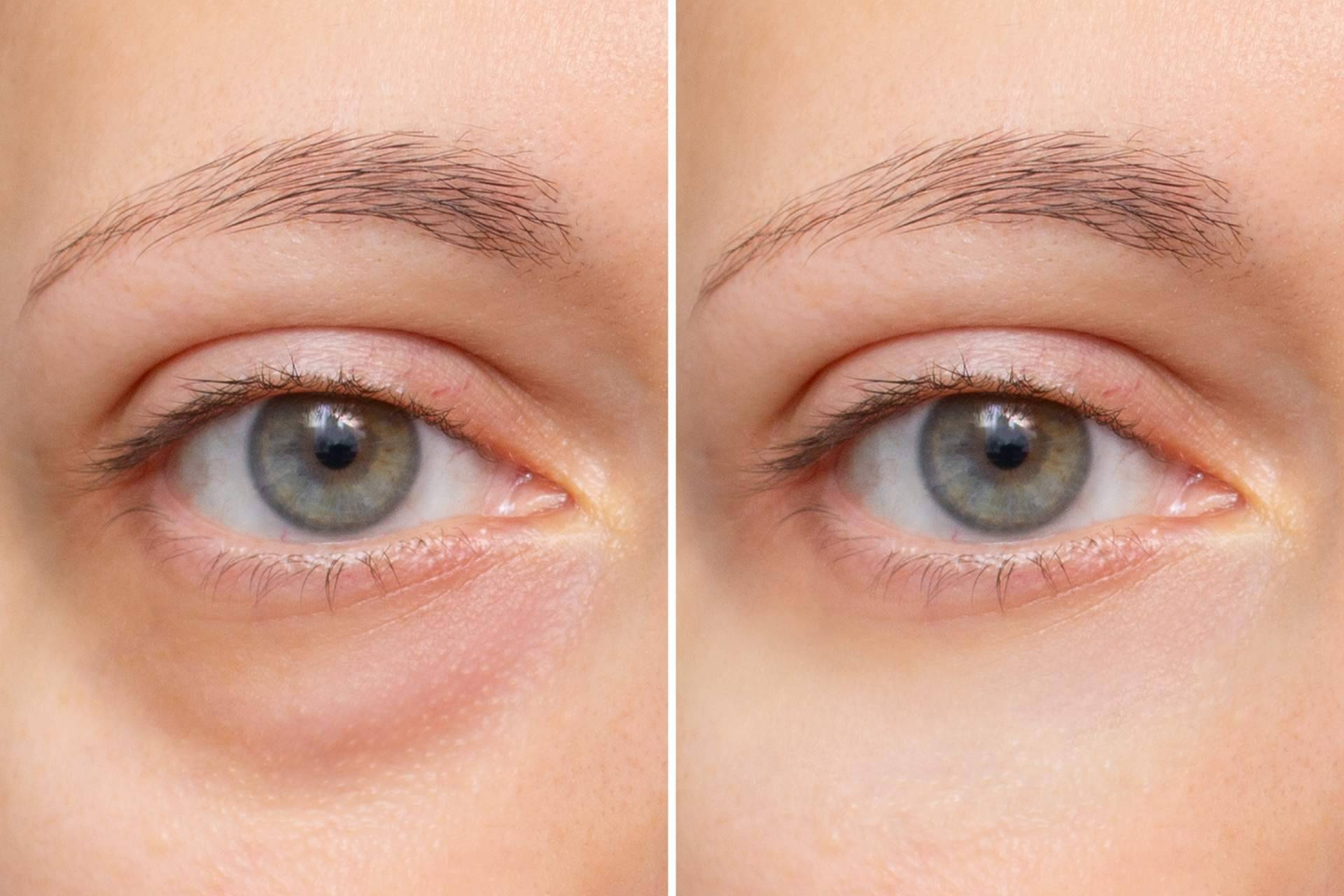 Departamento de Oftalmología del Hospital Universitario Dexeus, referentes en oculoplastia y blefaroplastia en Barcelona