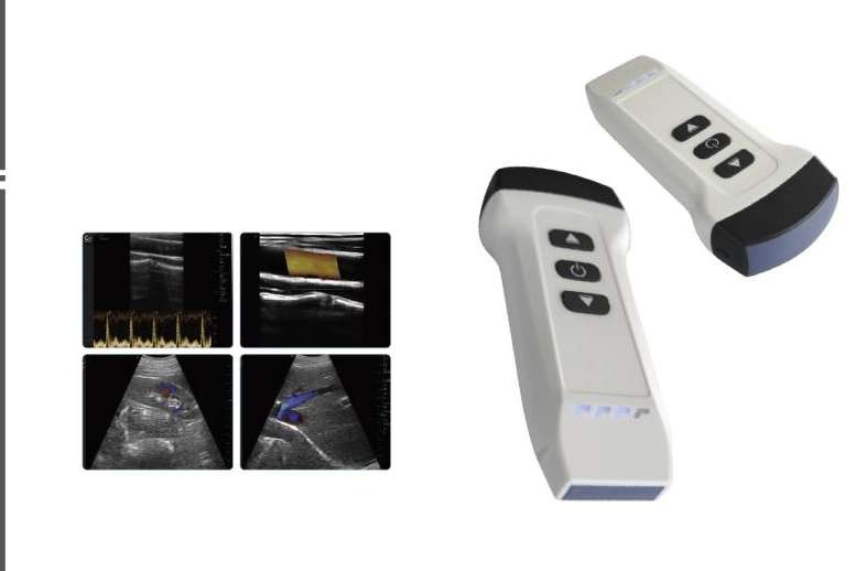 SCPmedical presenta su ecógrafo inalámbrico, portabilidad y precisión para la atención médica