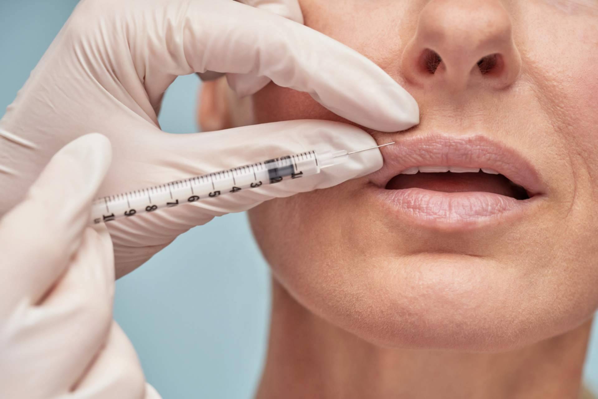 Centro Estetica el Pilar eleva la estética labial con ácido hialurónico de última generación
