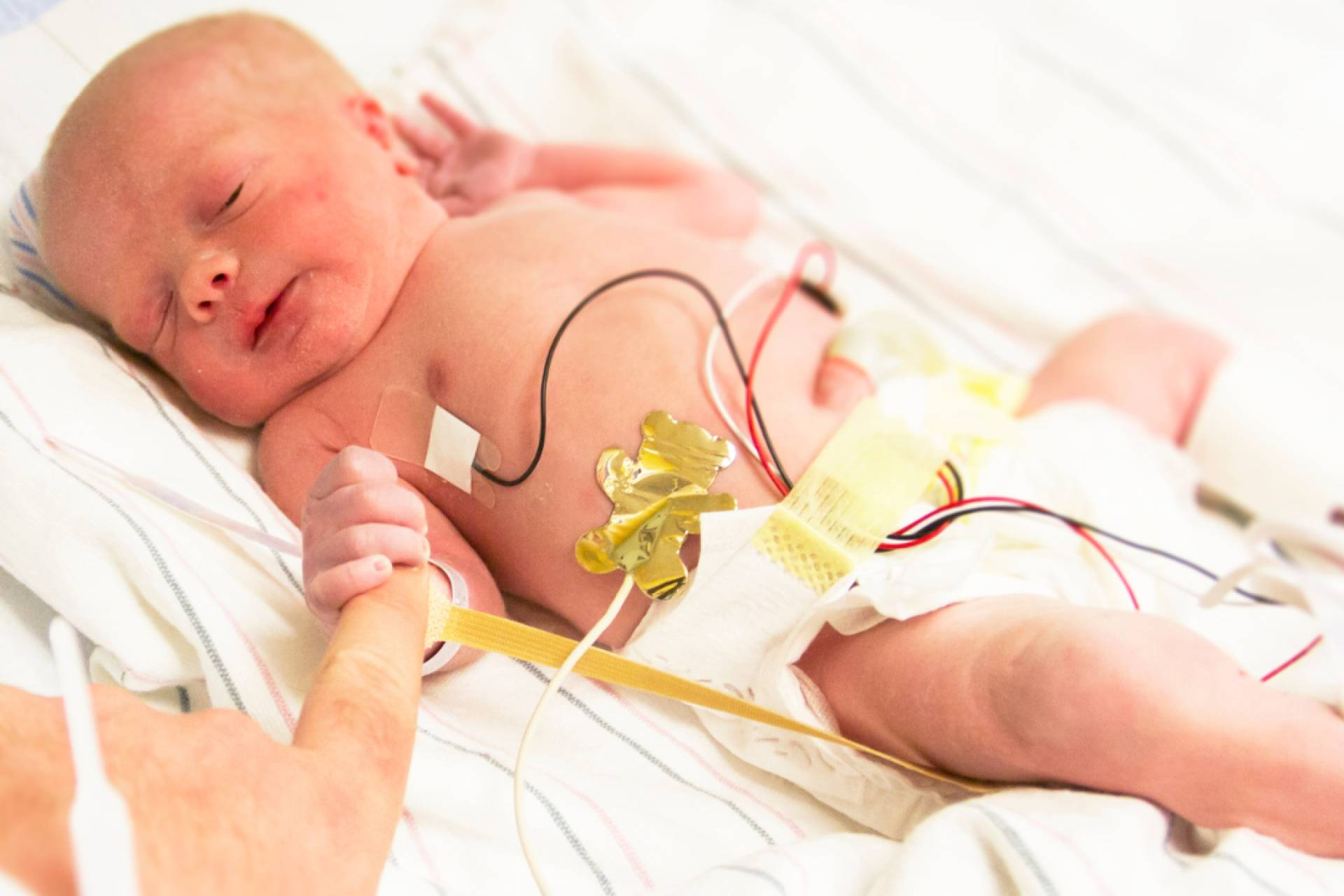 Cuando la vida se adelanta, el viaje invisible de las familias de bebés prematuros