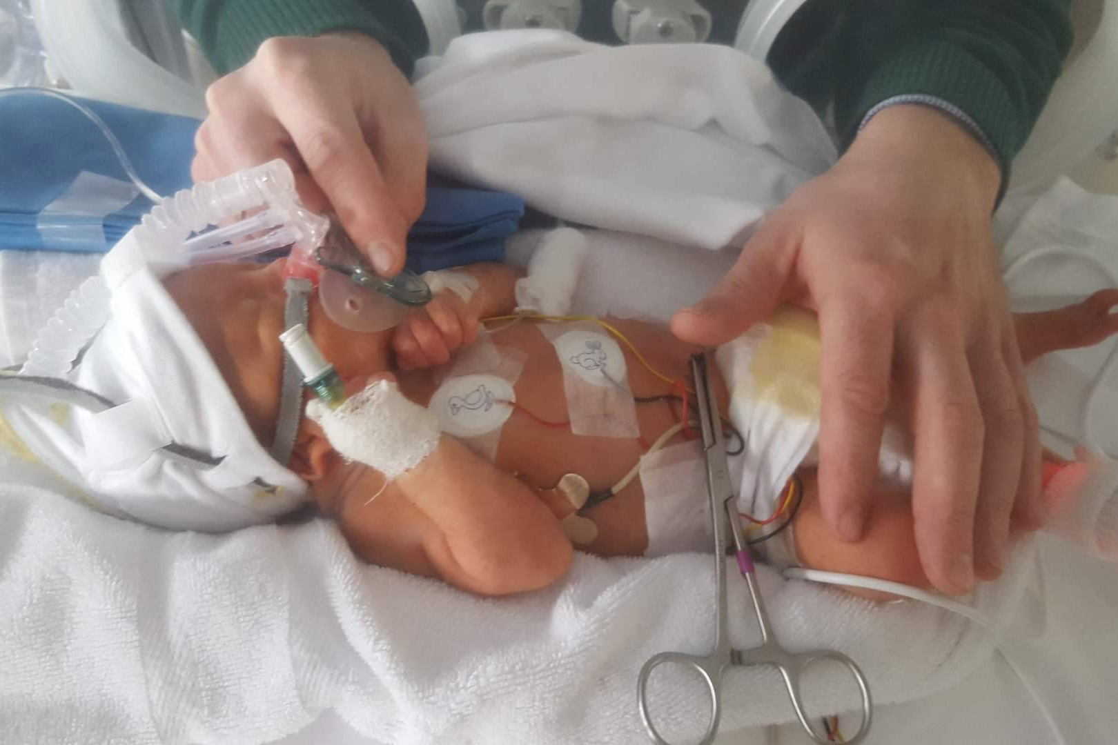 Día Mundial de la Prematuridad; detrás de cada bebé hay una familia que no se rinde